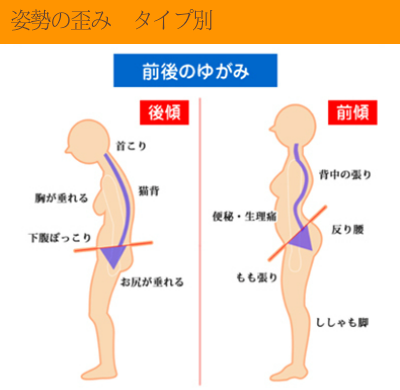 腰痛・肩こり対策のオーダーメイド枕にする為に　大阪　睡眠改善研究室は姿勢の歪みも測る１
