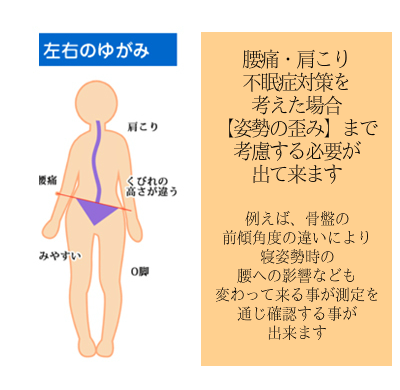 腰痛・肩こり対策のオーダーメイド枕にする為に　大阪　睡眠改善研究室は姿勢の歪みも測る２
